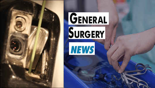 duoendoscopy general surgery news